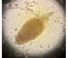 /ARSUserFiles/oirp/OBCL/OBCL Research Highlights/images/March 2023/mite midrib 1.png